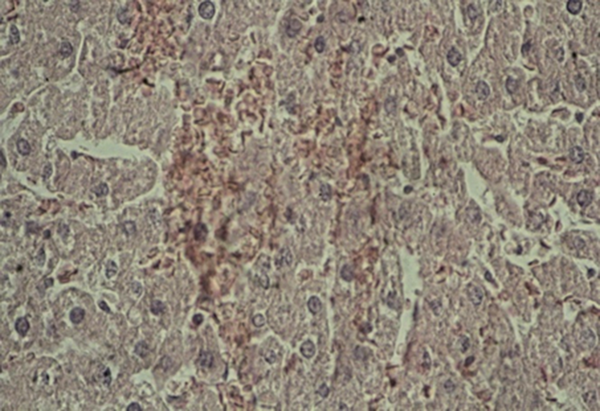 Light Micrographs of Sections in the Liver of TiO2-Treated Rat Received 10 ppm, Every Day for 7 Successive Days (Group 1) Demonstrating of Changes Histopathology