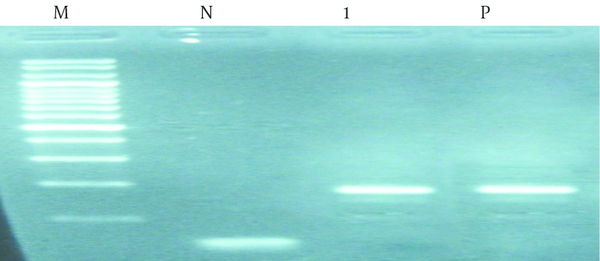 DNA extracted from tissues was amplified with specific primers. Amplification of fragment yielded a band of 167 bp. Positive control (P); negative control (N); clinical sample, lanes 1; DNA molecular weight marker (M).