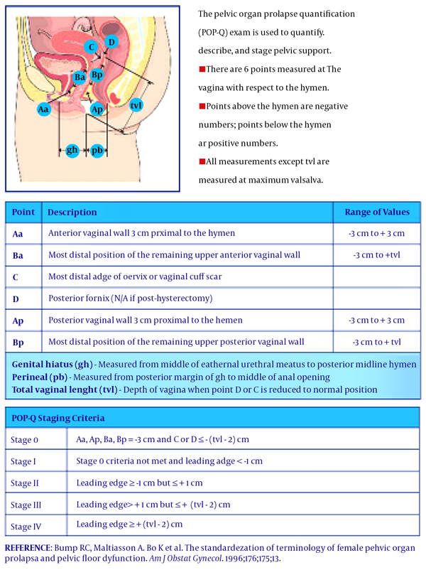 Causes of uterine prolapse