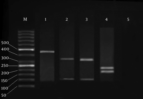 M, Molecular marker at 50 bp, Line 1, Standard C. fasciculata Line 2, Band profiles generated by DdeI enzyme, Line 3, Band profiles generated by ScrFI enzyme, Line 4, Band profiles generated by TaqI enzyme, Line 5, Negative control.