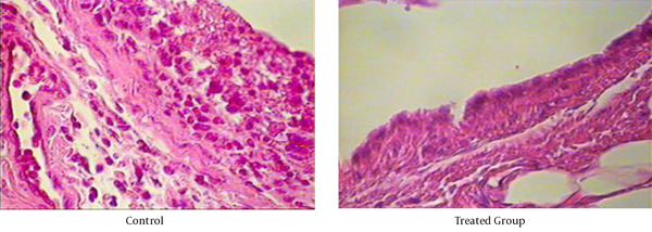 Hematoxylin and Eosin Staining of a Hind Joint of an Arthritic Animal Treated with CSS and Non-Treated Lewis Rat, a Control Rat with Collagen-Induced Arthritis, Depicted in 400 × Magnifications
