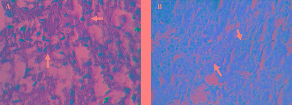 A, The cells in the scaffold were scattered, inactivation of cells could be seen (peak Indigo, 400 ×); B, H&amp;E, 400 ×.