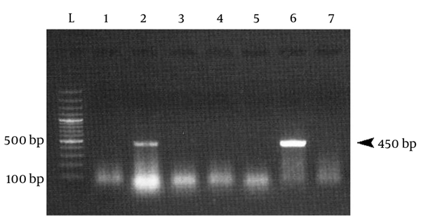 Lane L, 100 bp DNA ladder (Fermentas); lanes 2 and 6, HPV positive samples contained 450 bp amplicon from HPV genome.