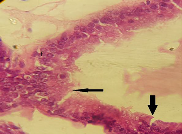 The Cross Section of Prostate Tissue in Treated Group with BPA at 50µg/kg, Showed Rupturs (Arrows) in Epithelium of the Secretory Units (H&amp;E ×400)