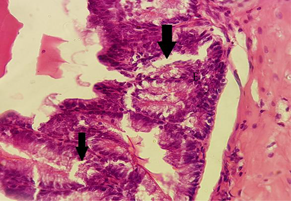 The Cross Section of Vesicle Seminal Gland in Treated Group with BPA at 100 µg/kg, Rupturs (Arrows) Were Seen in Epithelium of the Folds Compared with the Control Group (H&amp;E × 400)