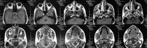 Axial Sections of Magnetic Resonance Imaging