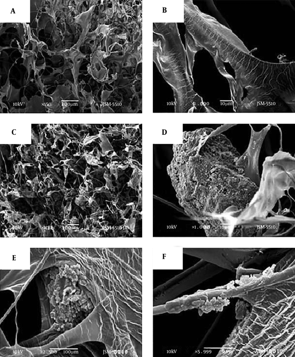 Scanning Electron Microscopy Images of Porous Collagen Matrix Without Reduced Graphene Oxide (A, B) and of Collagen/RGO composite, 2:1 wt/wt (C, D, E, F)