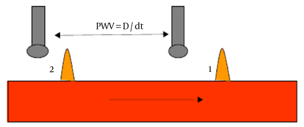 The transit time (dt) between the pulse waves, and the distance (D) between the two sensors were taken in account.