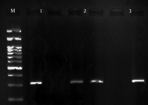 M: DNA marker 100bp; Product size: 319 bp; sample 1: A, sample 2: AG, sample 3: G.