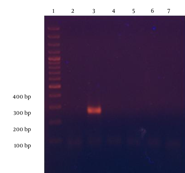 Each lane represents: 1) 100 bp DNA ladder, 2) negative control, 3) S. typhimurium, 4) E. Coli, 5) Proteus mirabilis, 6) Klebsiella pneumoniae, and 7) Citrobacter freundii.