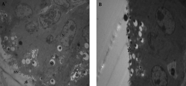 A (× 1670), The normal tissue of the vesicle seminal gland BPA in control group included: Microvilli (MV), Nuclei (N), and other celluar organells; B (× 1293), The microvilli (star) of the treated group with 100 µg/kg were disappeared.