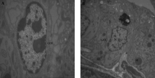 A (× 3597) and B (× 1670): Epithelial Cells of the Prostate in the Control Group including (M) Mitochondria, (N) Nuclei, (GER) Granular Endoplasmic Reticolum