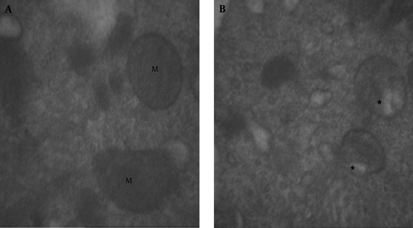 A, The Normal Mitochondria (M) in the Control Group (× 21560); B, In Mitochondries of the Treated Group with BPA at 100 µg/kg, Vacoulization (star) Was Seen (× 16700)