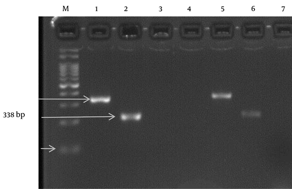 M, DNA Marker (100 bp); 1, positive HCV 1a genotype control (338 bp); 2, positive HCV 3a genotype control (227 bp); 3 and 4, negative HCV controls; 5, clinical positive sample HCV 1a genotype; 6, clinical positive sample HCV 3a genotype; 7, clinical negative sample.