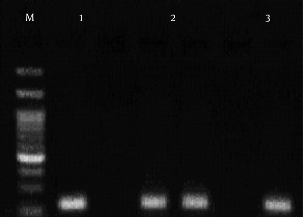 M: DNA marker 100bp; Product size: 223 bp; sample 1: A, sample 2: AG, sample 3: G.