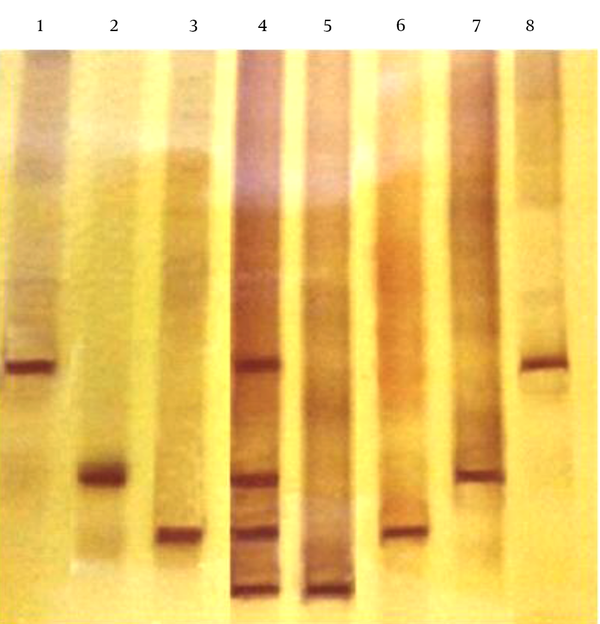 Each lane represents: 1) sausage sample inoculated with S. typhi, 2) with S. paratyphi B, 3) with S. typhimurium, 4) diversity ladder, 5) S. dublin, 6) S. typhimurium, 7) S. paratyphi B, and 8) S. typhi.