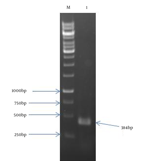 Lane 1: 384 bp Mtb32C PCR product; Lane M: 1 kb DNA size marker.