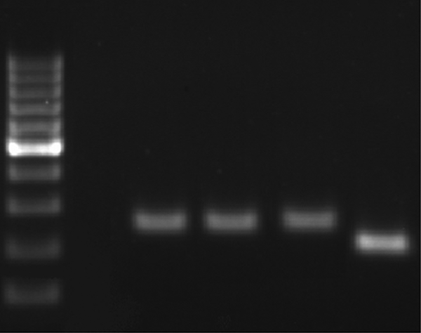 Electrophoresis of iceA Gene PCR Products on 12% Acrylamide Gel: Lane 1; Marker, Lane 2; Negative Control, Lane 3, 4, 5; iceA1 Positive (247 bp) and, Lane 6; iceA2 Positive (229 bp)