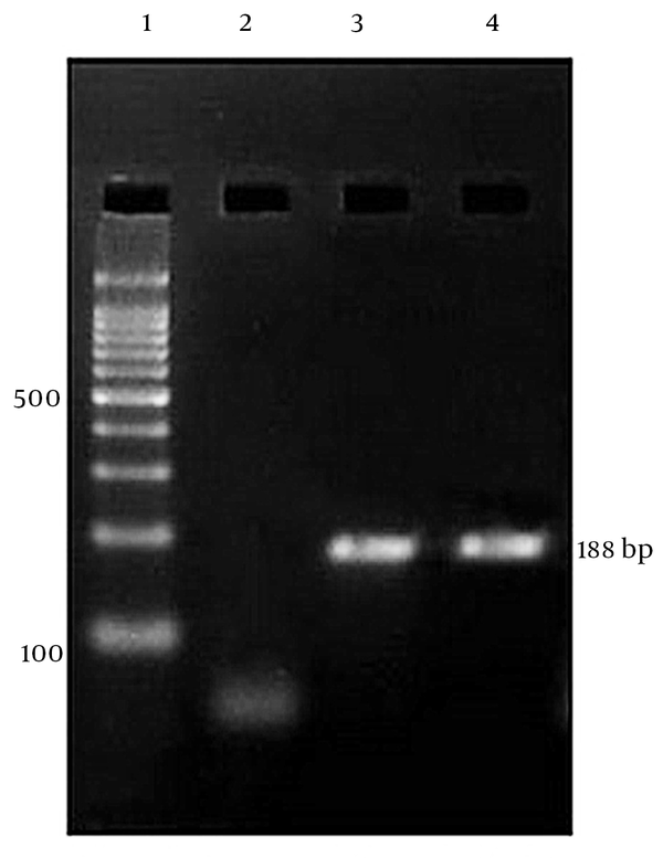 From left: Lane 1; DNA Ladder (100 bp), Lane 2; negative sample, Lane 3 and 4; positive samples.