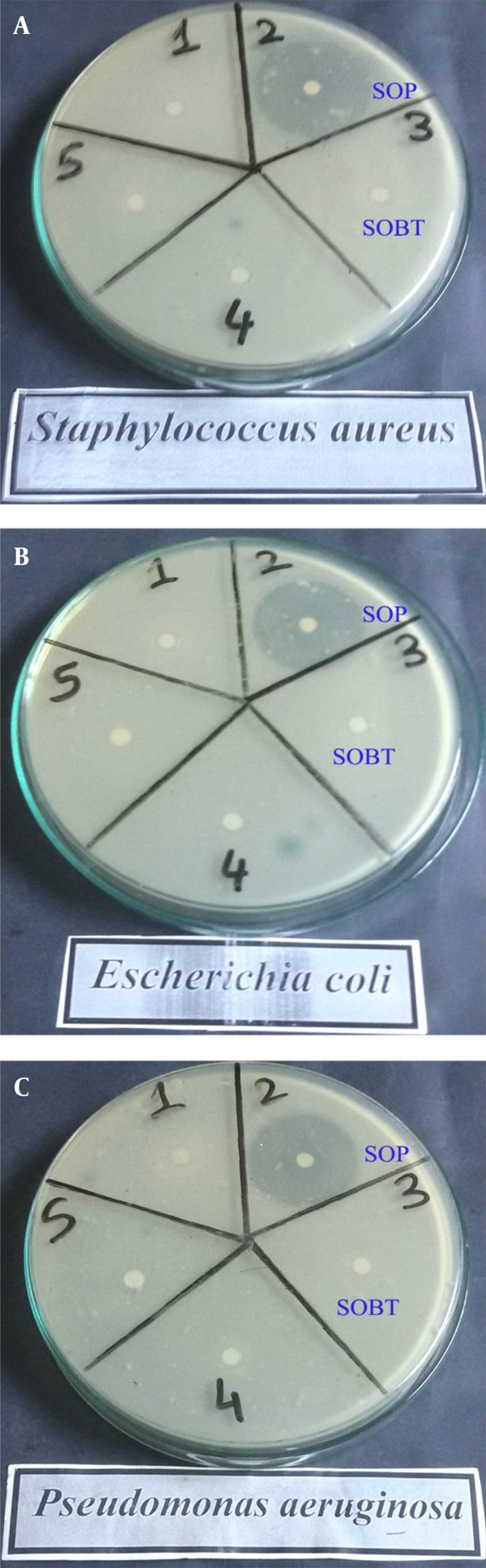 Antibacterial Activity of SOBT and SOP Extracts Against Different Gram-Positive and Gram-Negative Bacteria