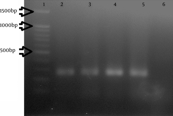 Gel Electrophoresis of the Polymerase Chain Reaction Products From CtxA Gene