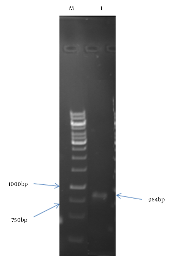 Lane M: 1 kb size marker; Lane 1: PCR product.