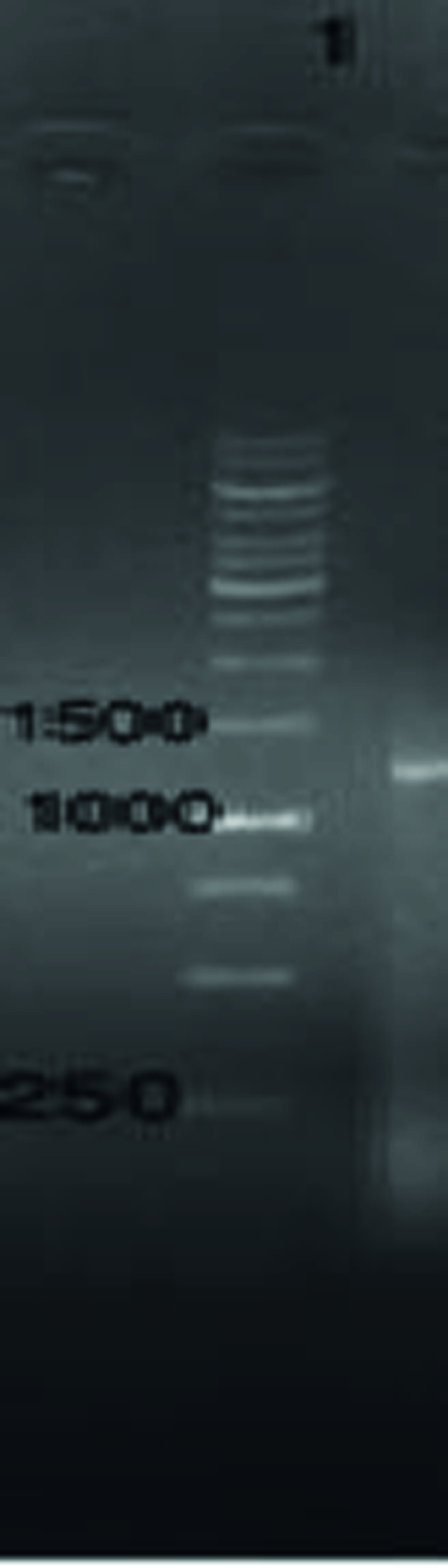 Lane 1: Molecular weight marker (1 kb ladder); Lanes 2 and 3: amplified ROP1 with 1183 bp band.