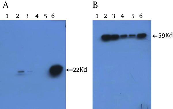 1, 5 µL Bl21 without Plasmid; 2, 10 µL Supernatant of sonicated Bacteria; 3, 5 µL Supernatant of sonicated Bacteria; 4, 2 µL Supernatant of sonicated Bacteria; 5, 1 µL Supernatant of sonicated Bacteria; 6, 5 µL pellet of sonicated Bacteria
