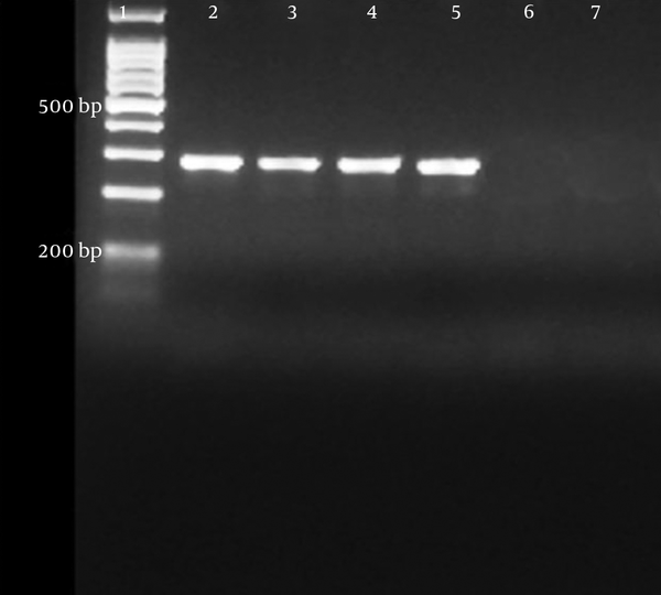 Lane 1, 100 bp DNA ladder; lane 2, sample 2; lane 3, sample 3; lane 4; sample 4; lane 5, sample 5; lane 6, negative control.