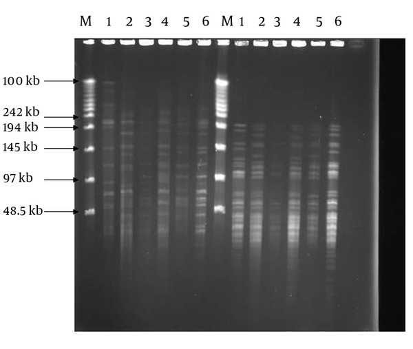 M. DNA weight marker, 1. BCG;  2. M. tuberculosis H37Rv; 3-6 clinical isolates: DraI digests (left); XbaI digests (right)