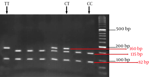 Restriction digestion for the CC genotype generated 135, 82 and 25 bp fragments, whereas the CT genotype generated 160, 135, 82 and 25 bp and the TT genotype produced 160 and 82 bp fragments.