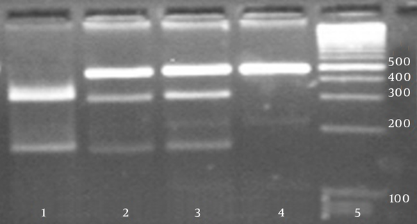 1, Genotype CC (300 + 160 bp), 2 and 3, genotype CT (460 + 300 + 160 bp), 4,            genotype TT (460 bp), and 5, 100 bp DNA ladder.