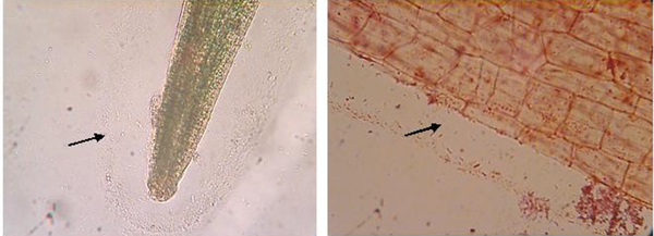 Arrow shows a biofilm or thin layer around the roots with the presence of Gram-negative Bacilli