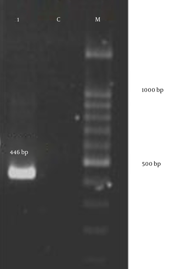 1, E. faecalis strain with tetM gene; C-, E. faecalis strain 29212 as negative control; M, marker 100 bp.