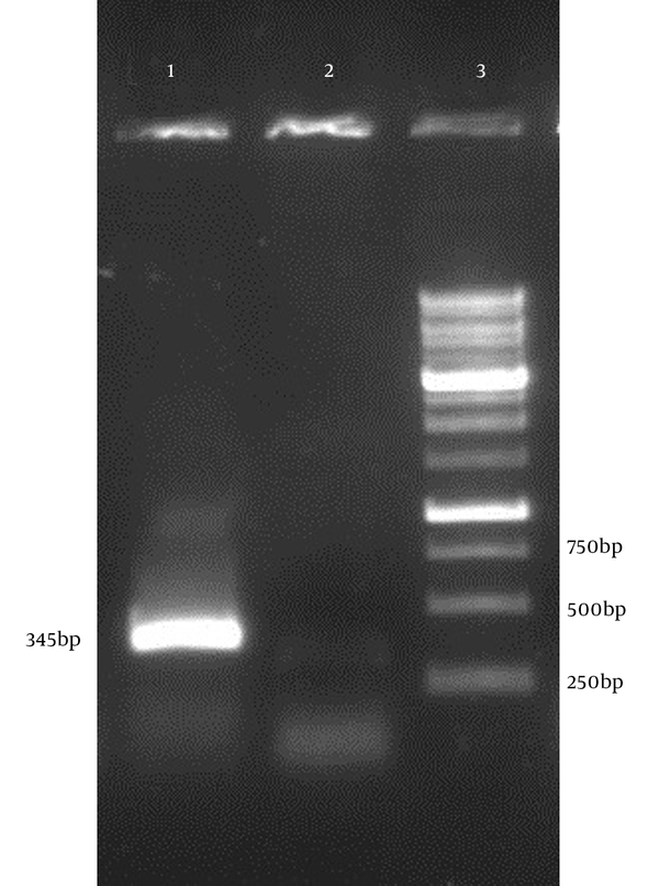 Lane 1: Single expected band of the hpd gene (345 bp), Lane 3: 1kb DNA size marker.
