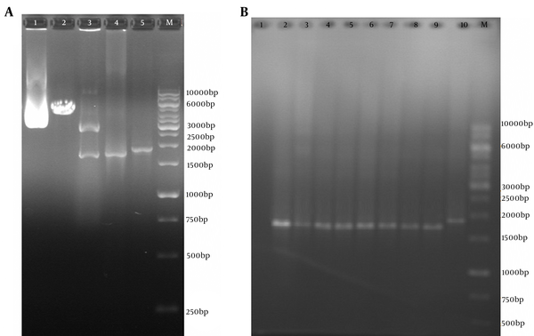 A, Polymerase Chain Reaction Results of pVAX-Truncated ORF2 (aa 112 - 660) Expression Plasmid (without PADRE and tPAsp sequences); Lane M, 1 kb DNA marker; Lane 1, pVAX-truncated ORF2 (aa 112 - 660) plasmid; Lane 2, digested pVAX-truncated ORF2 (aa 112 - 660) plasmid by NheI restriction enzyme (4596 bp fragment); Lanes 3, digested pVAX-truncated ORF2 (112 - 660) plasmid by NheI and XhoI restriction enzymes and production of two expected fragments, a 2909-bp and a 1693-bp fragment; Lanes 4, PCR product of truncated ORF2 (aa 112-660) gene (without PADRE and tPAsp sequences) with specific primers (1710 bp); Lanes 4, PCR product of tPAsp-PADRE-ORF2 (aa 112 - 660) gene (with PADRE and tPAsp sequences) with T7p and BGH primers (1876 bp); B, Colony Polymerase Chain Reaction Results of Colonies Containing the pVAX-Truncated ORF2 (aa 112 - 660) Expression Recombinant Plasmid; Lane M, 1 kb DNA marker; Lane 1, negative control; Lanes 2 - 9, 1774 bp band of pVAX-truncated ORF2 (aa 112 - 660) plasmid (without PADRE and tPAsp sequences) due to colony PCR assay with T7p and BGH universal primers; Lane 2, 1876 bp band of pVAX-tPAsp-PADRE-ORF2 (aa 112 - 660) plasmid (with PADRE and tPAsp sequences) due to colony PCR assay with T7p and BGH primers as controls