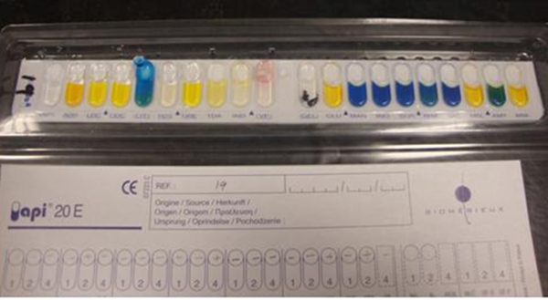 The Results of Biochemical Tests for Acinetobacter baumannii With API Kit