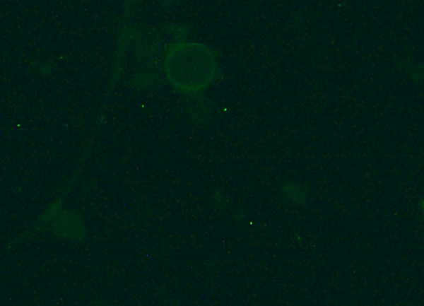 Cyclospora Oocysts Fluorescence Microscopy (400 x)