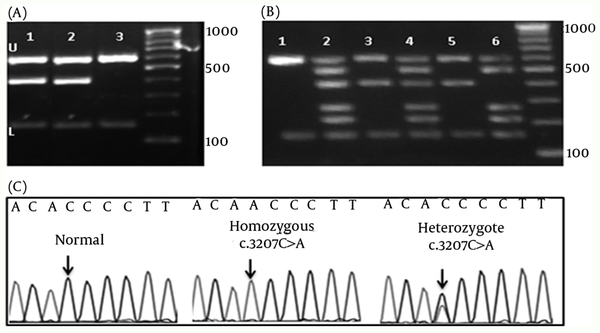 (A) Gel electrophoresis of Set 1, U: upper and L: lower controls are depicted for all lines. 1 and 2 show the band for the c.3207C &gt; A mutation.3: Normal DNA which shows only the control amplicons. 100bp DNA ladder is depicted in left. (B) Gel electrophoresis of the DNA bands of the hetero- and homozygote c.3207C &gt; A mutation. 1 and 2 shows the normal control DNA using Set 2 and 2A, respectively. 3 and 4 show the heterozygote c.3207C &gt; A mutation. 5 and 6 show patients with the homozygote c.3207C &gt; A mutation. 100bp DNA ladder is depicted in left. (C) Chromatograms of main mutation detected in Set 1.