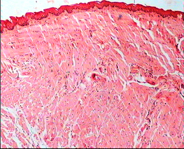 The squamous epithelium, sub-mucosal and tongue muscle is normal in BALB/c mice treated with 1.9 mg/kg/day b/w dose. H&E ×80.