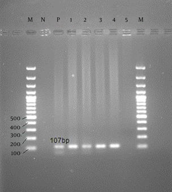 M: DNA molecular marker, N: negative control, P: positive Control, 5: negative cases, 1-4: positive cases.