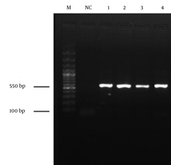 Polymerase Chain Reaction Products Obtained From Water Samples Following Internal Transcribed Spacer-Polymerase Chain Reaction. Lanes 1-4, PCR products of fungal species with a specific amplification product of 550 bp; NC, negative control; M, molecular weight ladder (100 - 3000 bp).