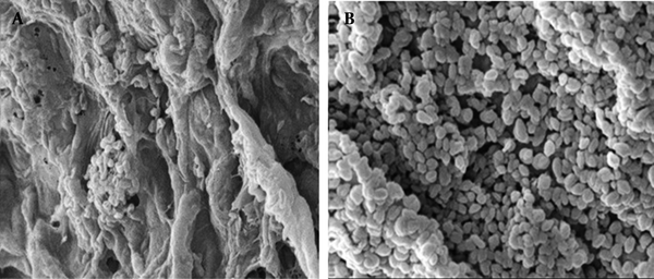 Scanning Electron Microscopy of Surface (a) and a Section (b) of an Alginate Bead