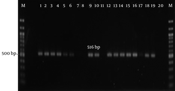 An amplicon size of nearly 516 bp was observed in lanes 1 - 6, 9 - 10, and 12 - 18. Lane M: 100 bp DNA ladder. Lanes 1 - 18 were loaded with PCR products from bacterial plasmid DNA samples, Lane 19: positive control, and Lane 20: negative control.