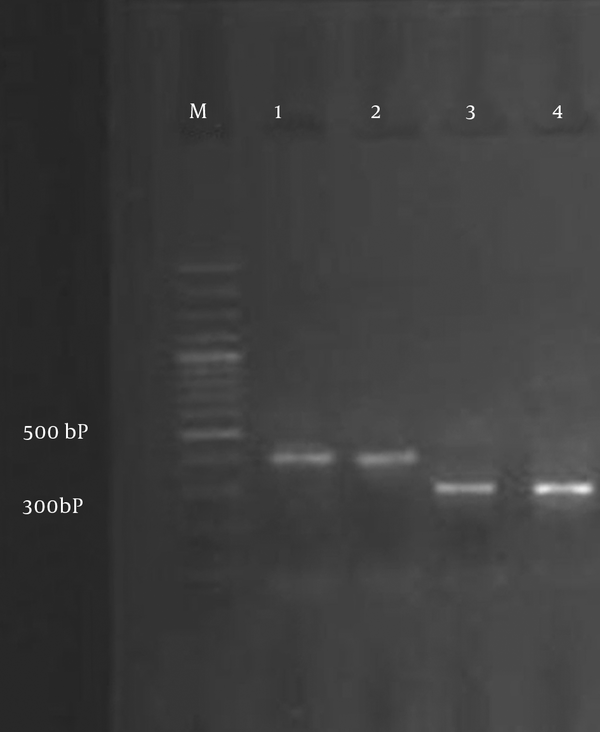 Lane M, 100 bp DNA marker; Lane 1, blaSHV from the positive control; Lane 2,E. coli clinical isolates expressing blaSHV; Lane 3, blaTEM from the positive control; Lane 4,K. pneumonia clinical isolates expressing blaTEM.
