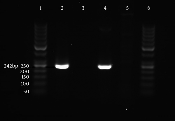 Lanes 1 and 6: 50 bp DNA ladder. Lane 2: isolate with blaVIM gene in 242 bp. Lane 3: isolate that is negative for blaVIM. Lane 4: positive control (clinical P.aeruginosa with sequenced blaVIM gene). Lane 5: negative control (distilled water).