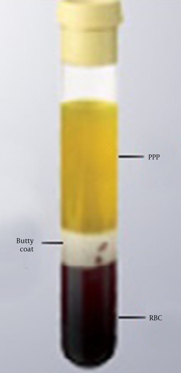 First-Stage Centrifuged Platelet-Rich Plasma