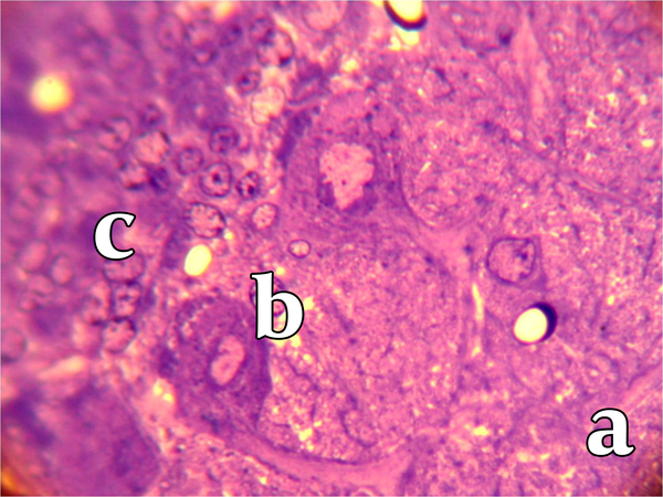 This figure shows diameter of Purkinje cells and distances between them increased in low-protein diet group. a, molecular layer; b, Purkinje cells layer; c, granular layer