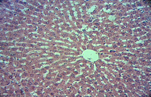 Microscopic View of the Liver Tissue in Studied Group (80 mg/kg), (H &amp; E × 100)