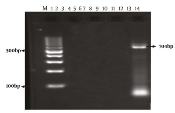 The PCR Amplification of Sb340 Genotype